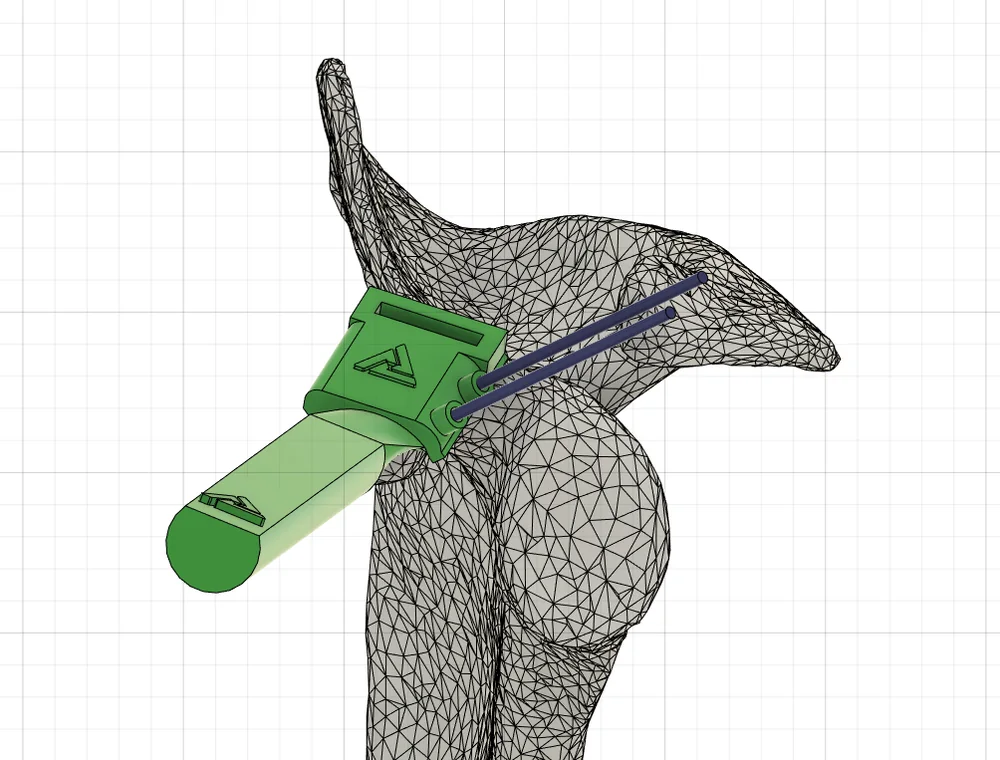 Diseño de una guía quirúrgica sobre la malla del hueso